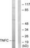 Lymphotoxin Beta antibody, A30476, Boster Biological Technology, Western Blot image 