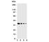 NTAL antibody, R31149, NSJ Bioreagents, Western Blot image 