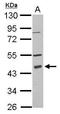 Programmed Cell Death 2 antibody, GTX115028, GeneTex, Western Blot image 