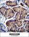 Hepatic triacylglycerol lipase antibody, 56-321, ProSci, Immunohistochemistry paraffin image 