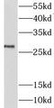 Lin-28 Homolog A antibody, FNab04783, FineTest, Western Blot image 
