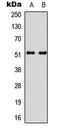 SMAD Family Member 3 antibody, LS-C368536, Lifespan Biosciences, Western Blot image 