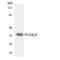 Fc Fragment Of IgG Receptor IIc (Gene/Pseudogene) antibody, LS-C291945, Lifespan Biosciences, Western Blot image 