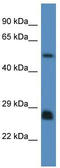 SHC Adaptor Protein 3 antibody, TA345003, Origene, Western Blot image 
