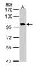 Transmembrane Protein 67 antibody, NBP1-32896, Novus Biologicals, Western Blot image 