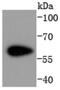 Cyclin Dependent Kinase 8 antibody, NBP2-67735, Novus Biologicals, Western Blot image 