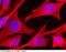 Heat shock 70 kDa protein 1A/1B antibody, 11660-R001, Sino Biological, Immunohistochemistry frozen image 