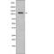 EPH Receptor A8 antibody, PA5-64576, Invitrogen Antibodies, Western Blot image 
