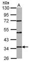 Progestin And AdipoQ Receptor Family Member 6 antibody, GTX122692, GeneTex, Western Blot image 