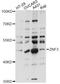 Zinc Finger Protein 3 antibody, LS-C749386, Lifespan Biosciences, Western Blot image 