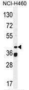 BSCL2 Lipid Droplet Biogenesis Associated, Seipin antibody, AP50395PU-N, Origene, Western Blot image 