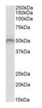 Fascin Actin-Bundling Protein 1 antibody, orb137163, Biorbyt, Western Blot image 