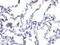 Ribonucleotide Reductase Regulatory TP53 Inducible Subunit M2B antibody, NBP1-76781, Novus Biologicals, Immunohistochemistry frozen image 