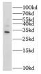 5'-Nucleotidase, Cytosolic IIIB antibody, FNab05876, FineTest, Western Blot image 