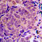 ALMS1 Centrosome And Basal Body Associated Protein antibody, GTX56177, GeneTex, Immunohistochemistry paraffin image 