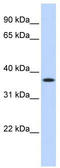 Methylenetetrahydrofolate Dehydrogenase (NADP+ Dependent) 2, Methenyltetrahydrofolate Cyclohydrolase antibody, TA338982, Origene, Western Blot image 