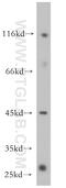 Transforming Growth Factor Beta Regulator 1 antibody, 18951-1-AP, Proteintech Group, Western Blot image 