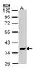 ATPase H+ Transporting V1 Subunit C2 antibody, LS-C186173, Lifespan Biosciences, Western Blot image 