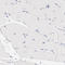 Visual system homeobox 2 antibody, HPA003436, Atlas Antibodies, Immunohistochemistry paraffin image 