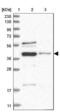 RNA Binding Motif Protein X-Linked 2 antibody, NBP1-85650, Novus Biologicals, Western Blot image 