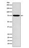 Glucosidase Alpha, Acid antibody, M01548-1, Boster Biological Technology, Western Blot image 