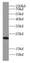 Heat Shock Protein Nuclear Import Factor Hikeshi antibody, FNab03863, FineTest, Western Blot image 
