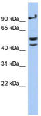 V-Set And Immunoglobulin Domain Containing 1 antibody, TA333389, Origene, Western Blot image 