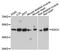 ADL antibody, A4109, ABclonal Technology, Western Blot image 