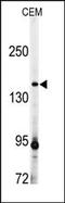 ADAMTS13 antibody, AP14085PU-N, Origene, Western Blot image 