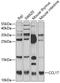 C-C Motif Chemokine Ligand 17 antibody, GTX32911, GeneTex, Western Blot image 