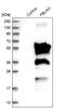 Filamin Binding LIM Protein 1 antibody, NBP1-86665, Novus Biologicals, Western Blot image 