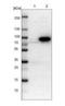 VPS10 domain-containing receptor SorCS1 antibody, NBP1-86096, Novus Biologicals, Western Blot image 