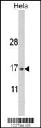 Protein Mpv17 antibody, 63-627, ProSci, Western Blot image 