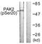 P21 (RAC1) Activated Kinase 2 antibody, LS-C199408, Lifespan Biosciences, Western Blot image 