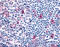 C-C chemokine receptor type 8 antibody, TA340919, Origene, Immunohistochemistry frozen image 