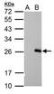 Regulator Of G Protein Signaling 17 antibody, PA5-21771, Invitrogen Antibodies, Western Blot image 