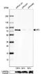 NF2 antibody, NBP1-87757, Novus Biologicals, Western Blot image 