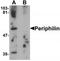 Periphilin 1 antibody, TA319929, Origene, Western Blot image 