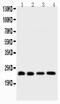 BH3 Interacting Domain Death Agonist antibody, PB9027, Boster Biological Technology, Western Blot image 