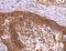 Abl Interactor 1 antibody, LS-C405400, Lifespan Biosciences, Immunohistochemistry paraffin image 