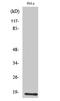Ubiquitin-conjugating enzyme E2 D2 antibody, A03971-1, Boster Biological Technology, Western Blot image 