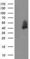 Leucine Rich Repeat Containing 25 antibody, TA504941BM, Origene, Western Blot image 