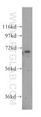 Zinc finger protein 143 antibody, 16618-1-AP, Proteintech Group, Western Blot image 