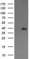 Mitogen-Activated Protein Kinase Kinase 3 antibody, TA505843S, Origene, Western Blot image 