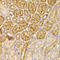 FPS antibody, LS-C334258, Lifespan Biosciences, Immunohistochemistry paraffin image 