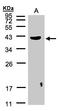 Pleckstrin antibody, LS-C185794, Lifespan Biosciences, Western Blot image 