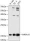 Mitochondrial Ribosomal Protein L43 antibody, 18-102, ProSci, Western Blot image 