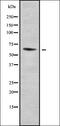 Elongator Acetyltransferase Complex Subunit 3 antibody, orb338292, Biorbyt, Western Blot image 