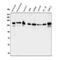 Epidermal Growth Factor Receptor Pathway Substrate 15 antibody, A01681-1, Boster Biological Technology, Western Blot image 