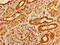 1-Acylglycerol-3-Phosphate O-Acyltransferase 3 antibody, LS-C673960, Lifespan Biosciences, Immunohistochemistry paraffin image 